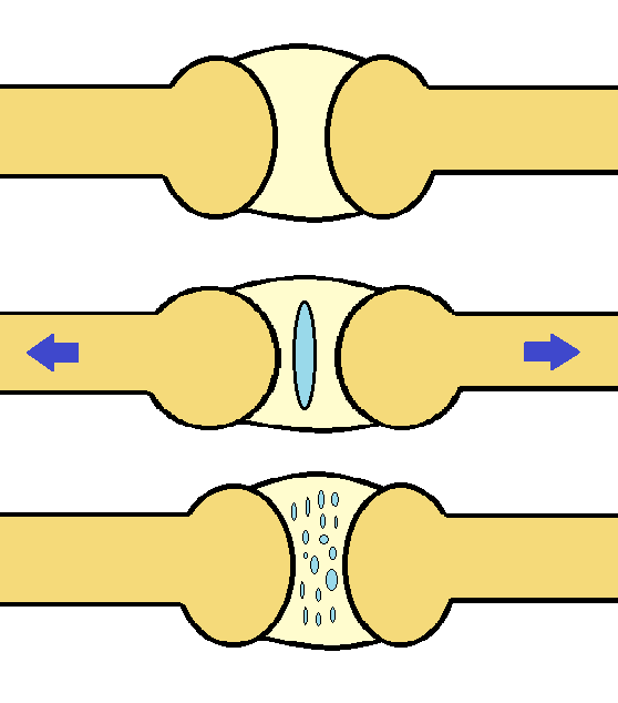joint-cavitation